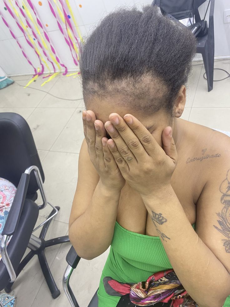 IMAGE OF THINNING ROOT HAIR THAT LEAVES YOU WONDERING IF A RELAXED HAIR CAN BE LOCKED?