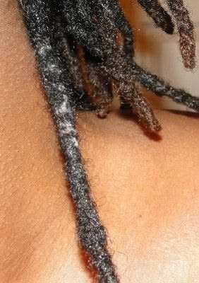 Buildup  in locs