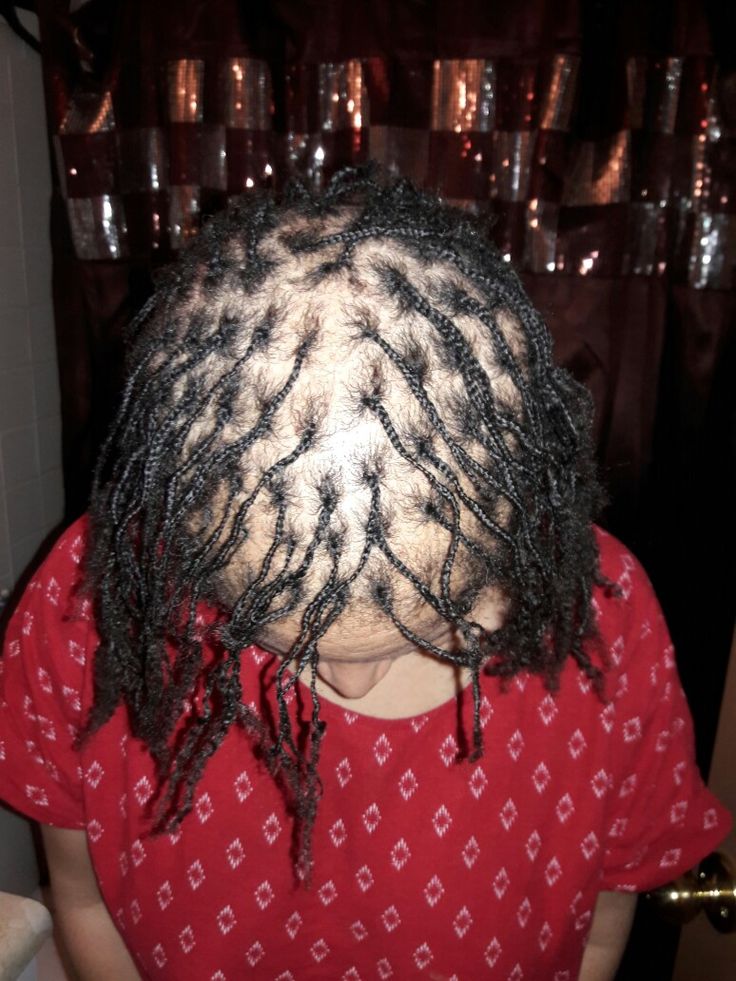 Starting Locs On Damaged Hair Safely