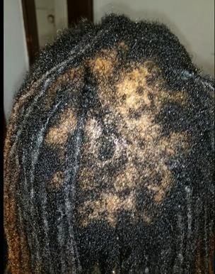 dry locs