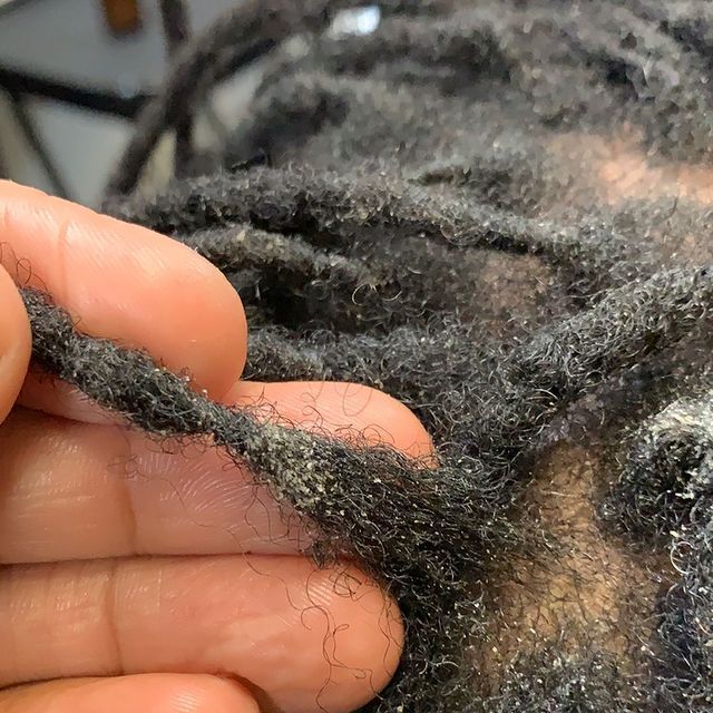Buildup in locs
