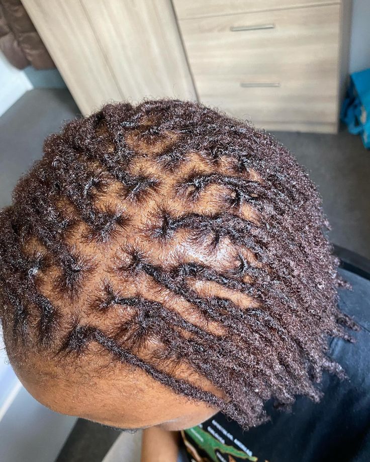 Healthy Scalp