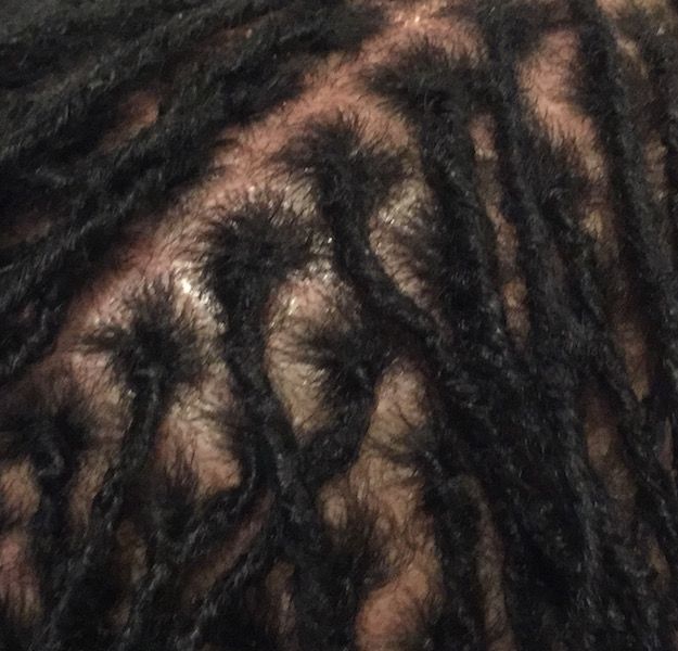 overmanuplated locs
